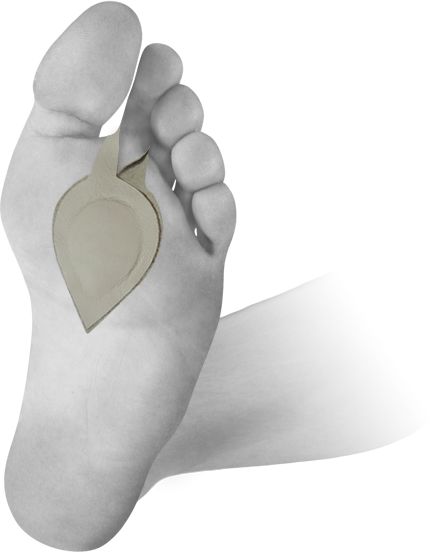 Pelota ortopedyczna na płaskostopie poprzeczne - z mocowaniem na palec (U-MED)